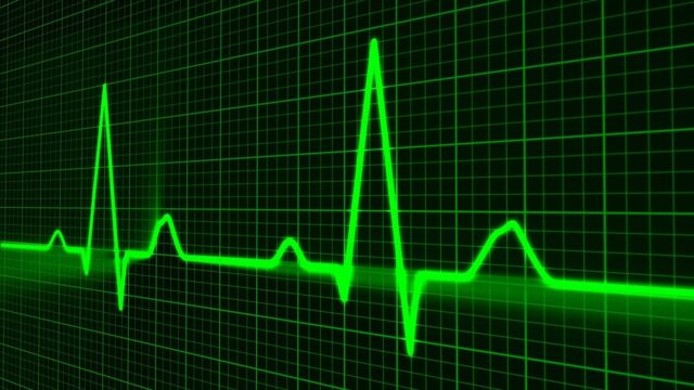 Green Heartbeat EKG Waveform Wallpaper In High Resolution