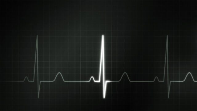 Heartbeat ECG Wallpaper Grayscale Background