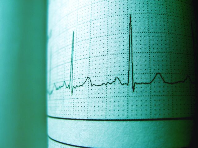 Heartbeat Wallpaper With ECG Rhythm Design